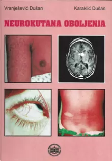 neurokutana_oboljenja