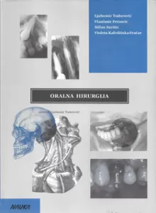 oralna_hirurgija