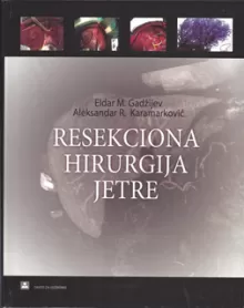 resekciona_hirurgija_jetre__cd