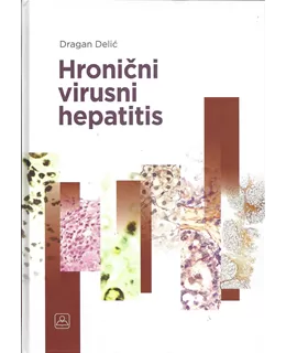 hronini_virusni_hepatitis