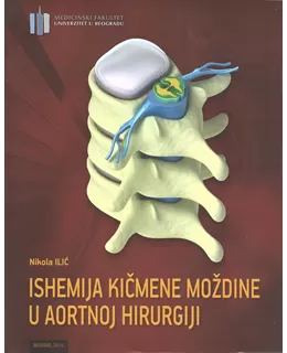 ishemija_kimene_modine_u_aortnoj_hirurgiji