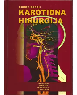 karotidna_hirurgija