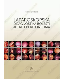laparoskopska_dijagnostika_bolesti_jetre_i_peritoneuma