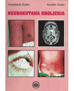 neurokutana_oboljenja