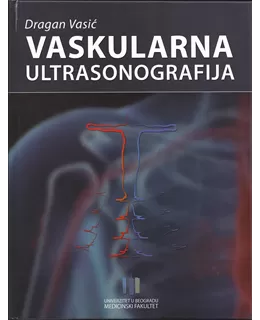 vaskularna_ultrasonografija