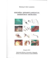 hirurka_revaskularizacija_isheminog_miokarda