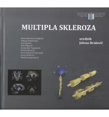 multipla_skleroza