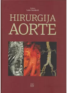 hirurgija_aorte