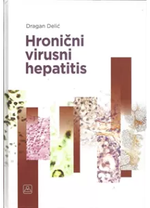 hronini_virusni_hepatitis