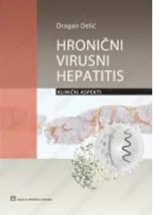 hronini_virusni_hepatitis_kliniki_aspekti