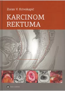 karcinom_rektuma