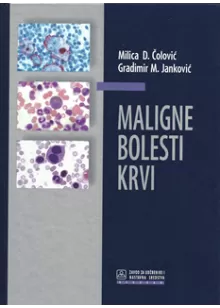 maligne_bolesti_krvi