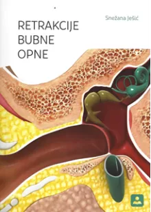 retrakcije_bubne_opne