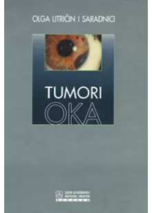 tumori_oka