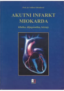 akutni_infarkt_miokarda