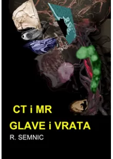 ct_i_mr_glave_i_vrata