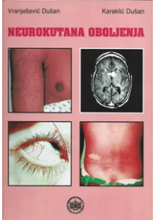 neurokutana_oboljenja