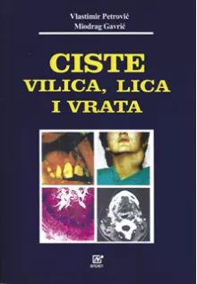 ciste_vilica_lica_i_vrata